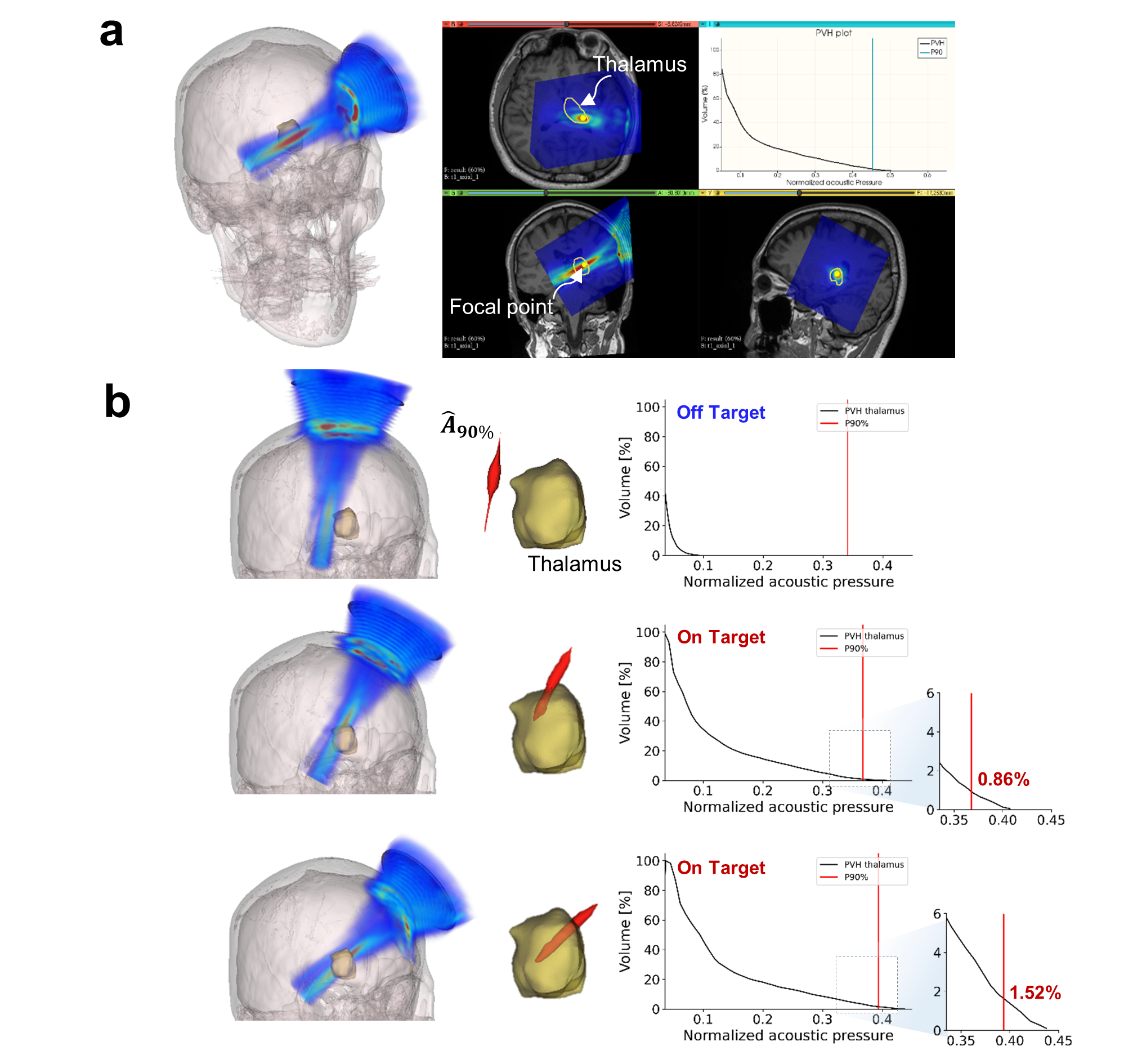[Figure 2] Clinical Application Examples for Simulation-Guided Navigation