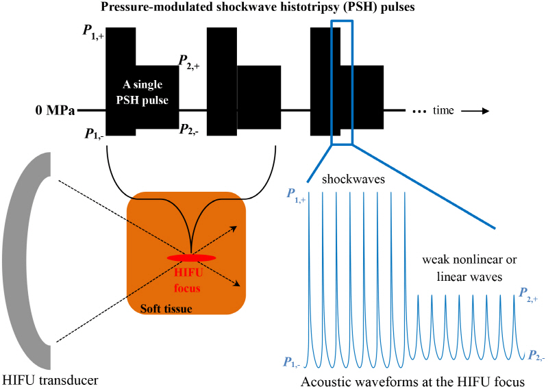 새로 개발한 집속초음파 기반 생체조직 파쇄 기술(가변압력 충격파 히스토트립시) 개념도: Pressure-modulated shockwave histotripsy