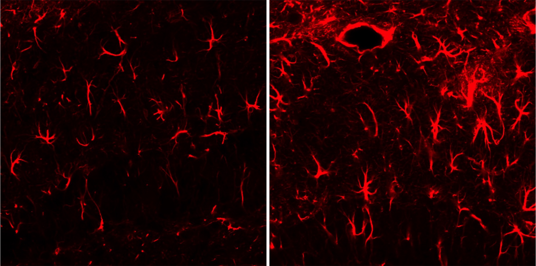 타우린에 의한 기억 담당 뇌부위(해마)의 신경교세포 활성화
