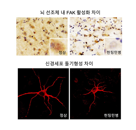 정상 및 헌팅턴병 환자의 뇌조직 내 FAK 활성화 정도 및 신경세포 돌기형성 차이