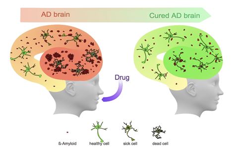 KIST, 세계최초로 알츠하이머병의 근원적 치료  가능한 신약 개발